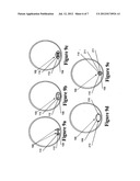 CONDUIT WITH HEATED WICK diagram and image