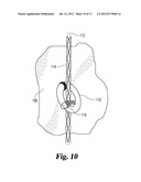 CHILD SAFETY LIFT CORD SYSTEM FOR WINDOW COVERINGS diagram and image