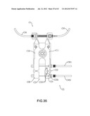 SAFETY BRAKING SYSTEM diagram and image