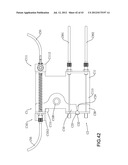 SAFETY BRAKING SYSTEM diagram and image