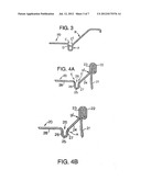 Can End diagram and image