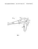 SURGICAL STAPLER WITH TIMER AND FEEDBACK DISPLAY diagram and image