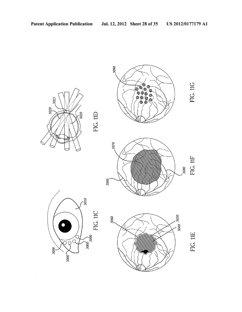 ORTHOVOLTAGE RADIOTHERAPY - diagram, schematic, and image 29