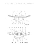 QUICK ADJUSTING NUT, ESPECIALLY FOR ATTACHING A VEHICLE WHEEL TO THE     MOUNTING SHAFT OF A BALANCING MACHINE diagram and image