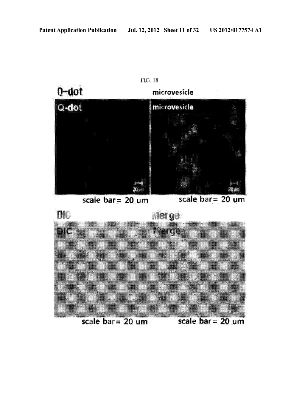 MICROVESICLES DERIVED FROM NUCLEATED, MAMMALIAN CELLS AND USE THEREOF - diagram, schematic, and image 12