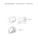 USE OF GINGIVAL FIBROBLASTS FOR VASCULAR CELL THERAPY diagram and image