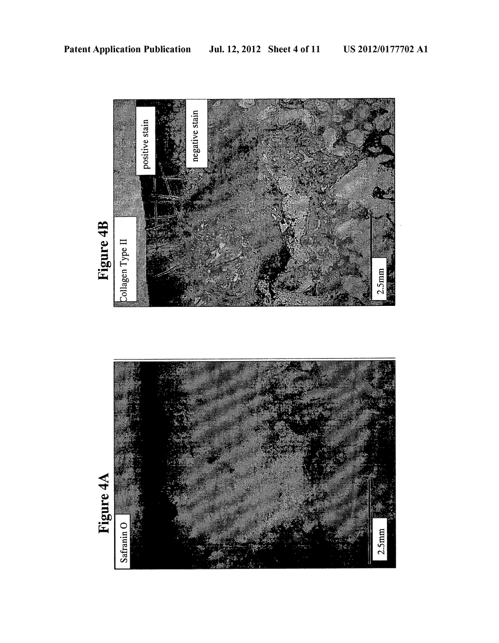 Solid Forms for Tissue Repair - diagram, schematic, and image 05