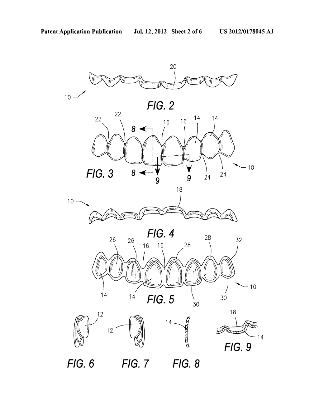 DENTAL DEVICE AND METHOD OF USE THEREOF - diagram, schematic, and image 03