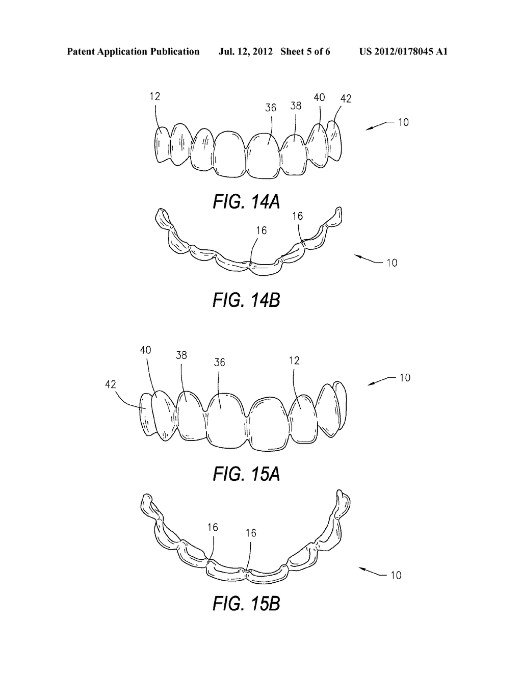 DENTAL DEVICE AND METHOD OF USE THEREOF - diagram, schematic, and image 06