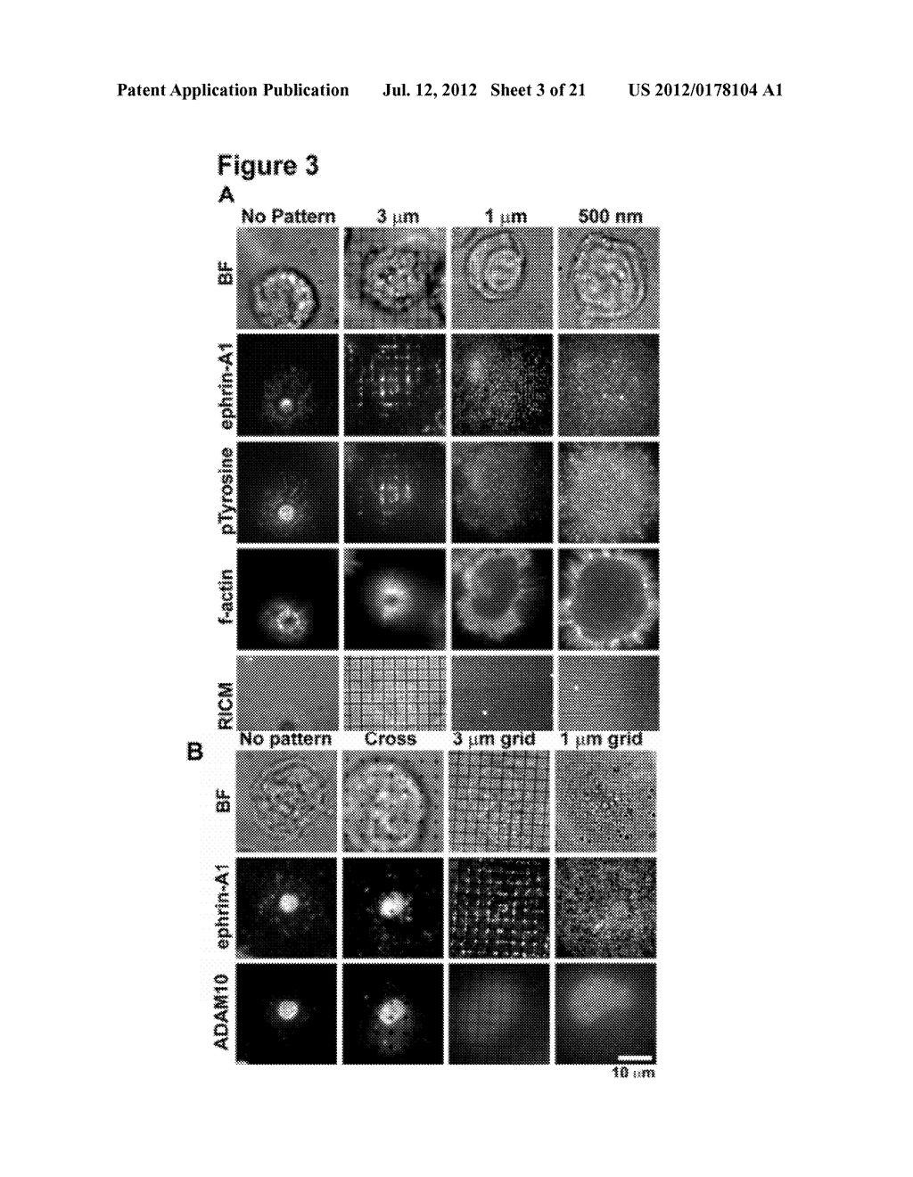 Spatial Biomarker of Disease and Detection of Spatial Organization of     Cellular Receptors - diagram, schematic, and image 04