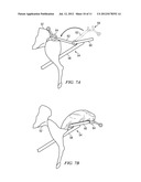 GAME CARCASS RETRIEVAL AND PROCESSING SYSTEMS diagram and image