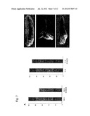 Compositions and methods for the inhibition of dishevelled proteins diagram and image