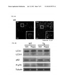 METHODS FOR TREATING FRONTOTEMPORAL LOBAR DEGENERATION WITH UBIQUITINATED     INCLUSIONS (FTLD-U) diagram and image