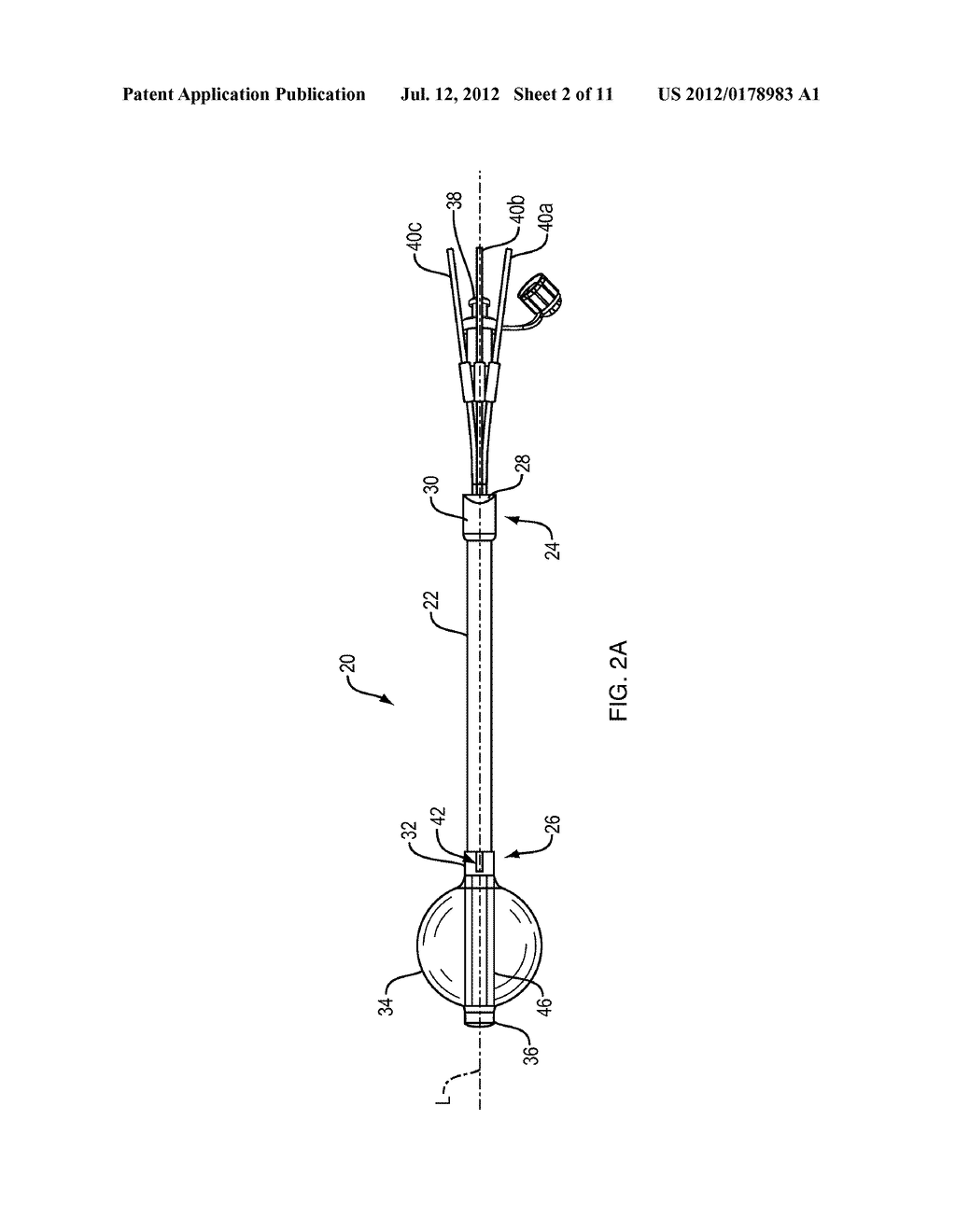 Orienting a Brachytherapy Applicator - diagram, schematic, and image 03