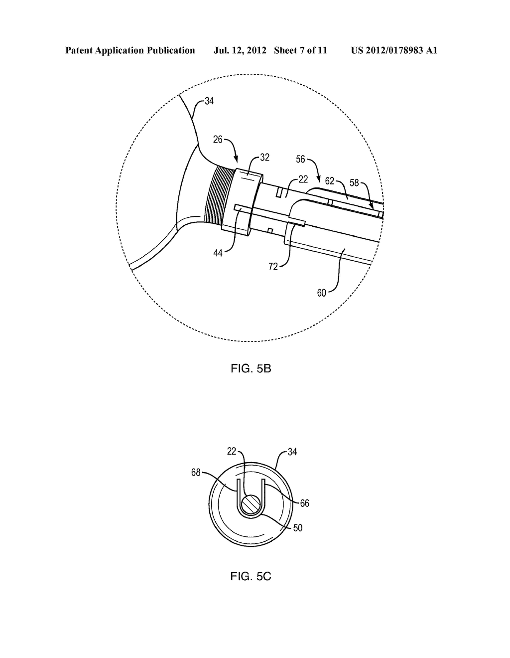 Orienting a Brachytherapy Applicator - diagram, schematic, and image 08