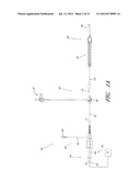 PERCUTANEOUS HEART PUMP diagram and image