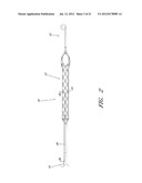 PERCUTANEOUS HEART PUMP diagram and image