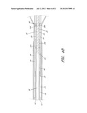 PERCUTANEOUS HEART PUMP diagram and image