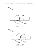 PERCUTANEOUS HEART PUMP diagram and image