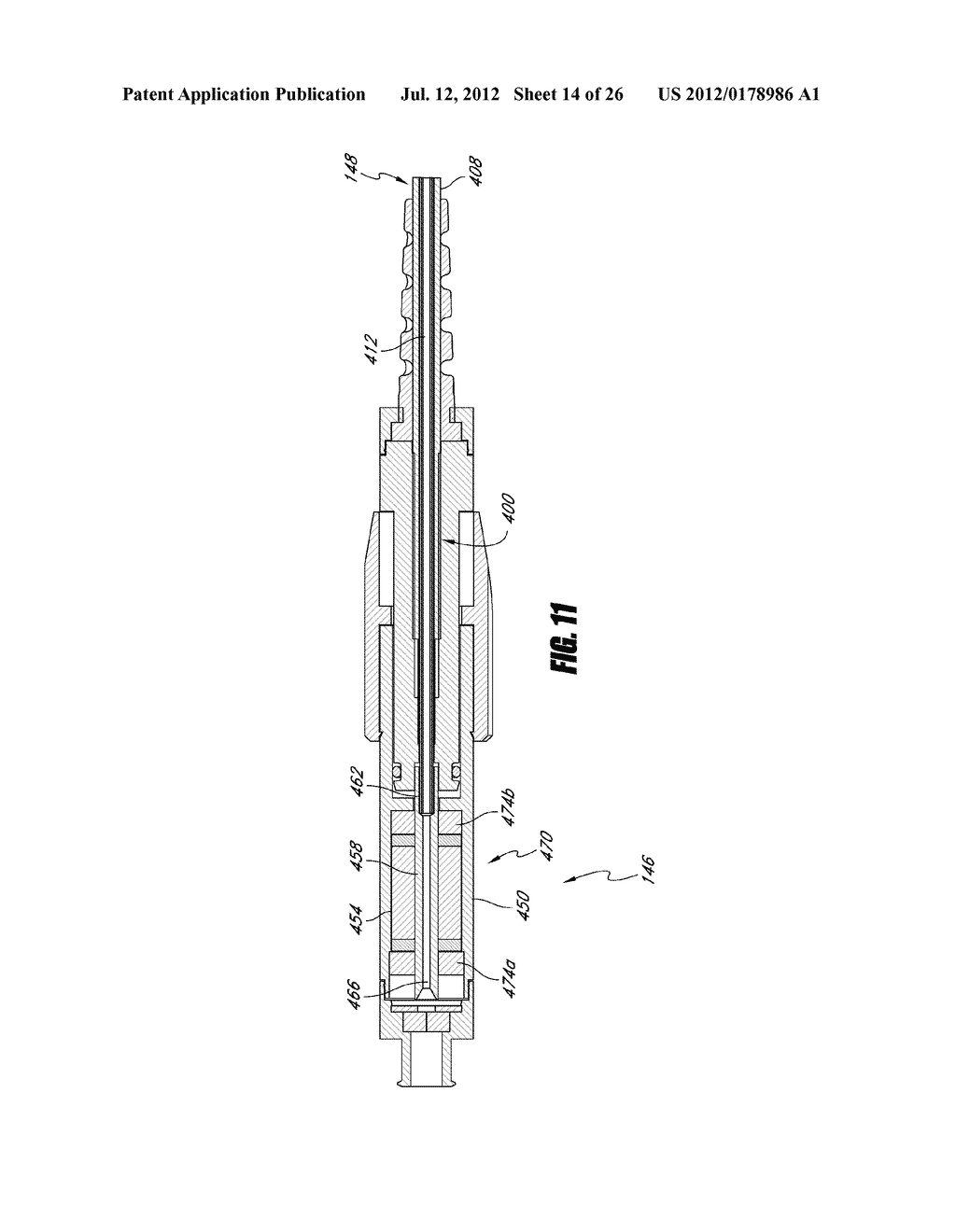 PERCUTANEOUS HEART PUMP - diagram, schematic, and image 15