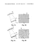 PERICARDIUM REINFORCING DEVICES AND METHODS FOR USING THEM diagram and image