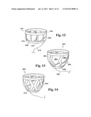 PERICARDIUM REINFORCING DEVICES AND METHODS FOR USING THEM diagram and image