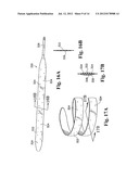 PERICARDIUM REINFORCING DEVICES AND METHODS FOR USING THEM diagram and image