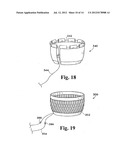 PERICARDIUM REINFORCING DEVICES AND METHODS FOR USING THEM diagram and image