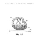 PERICARDIUM REINFORCING DEVICES AND METHODS FOR USING THEM diagram and image