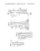 APPARATUS AND METHOD FOR ASSISTING IN THE DELIVERY OF MEDICAL INSTRUMENTS     INTO BODY ORGANS diagram and image