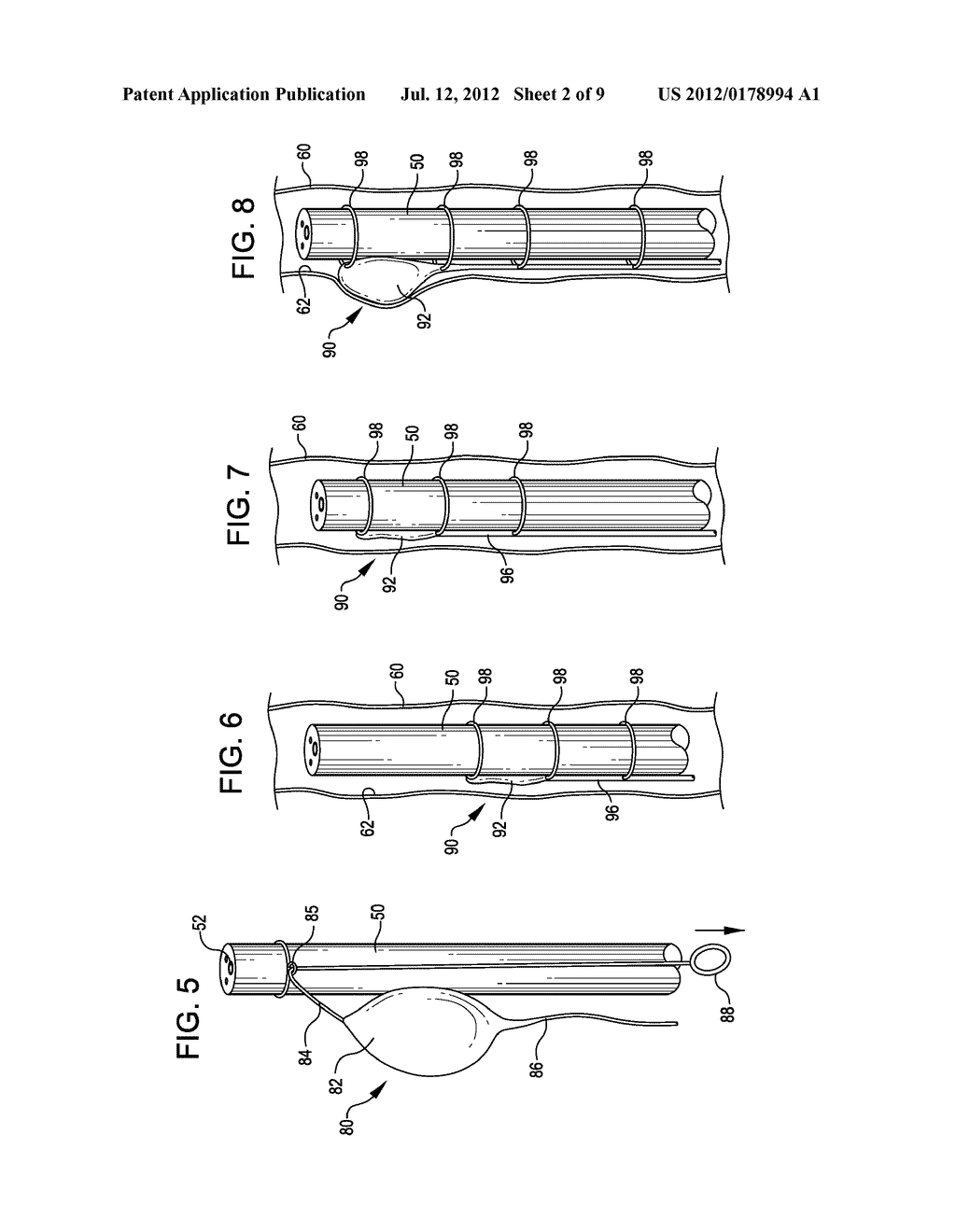 APPARATUS AND METHOD FOR ASSISTING IN THE DELIVERY OF MEDICAL INSTRUMENTS     INTO BODY ORGANS - diagram, schematic, and image 03