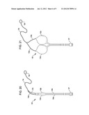 APPARATUS AND METHOD FOR ASSISTING IN THE DELIVERY OF MEDICAL INSTRUMENTS     INTO BODY ORGANS diagram and image