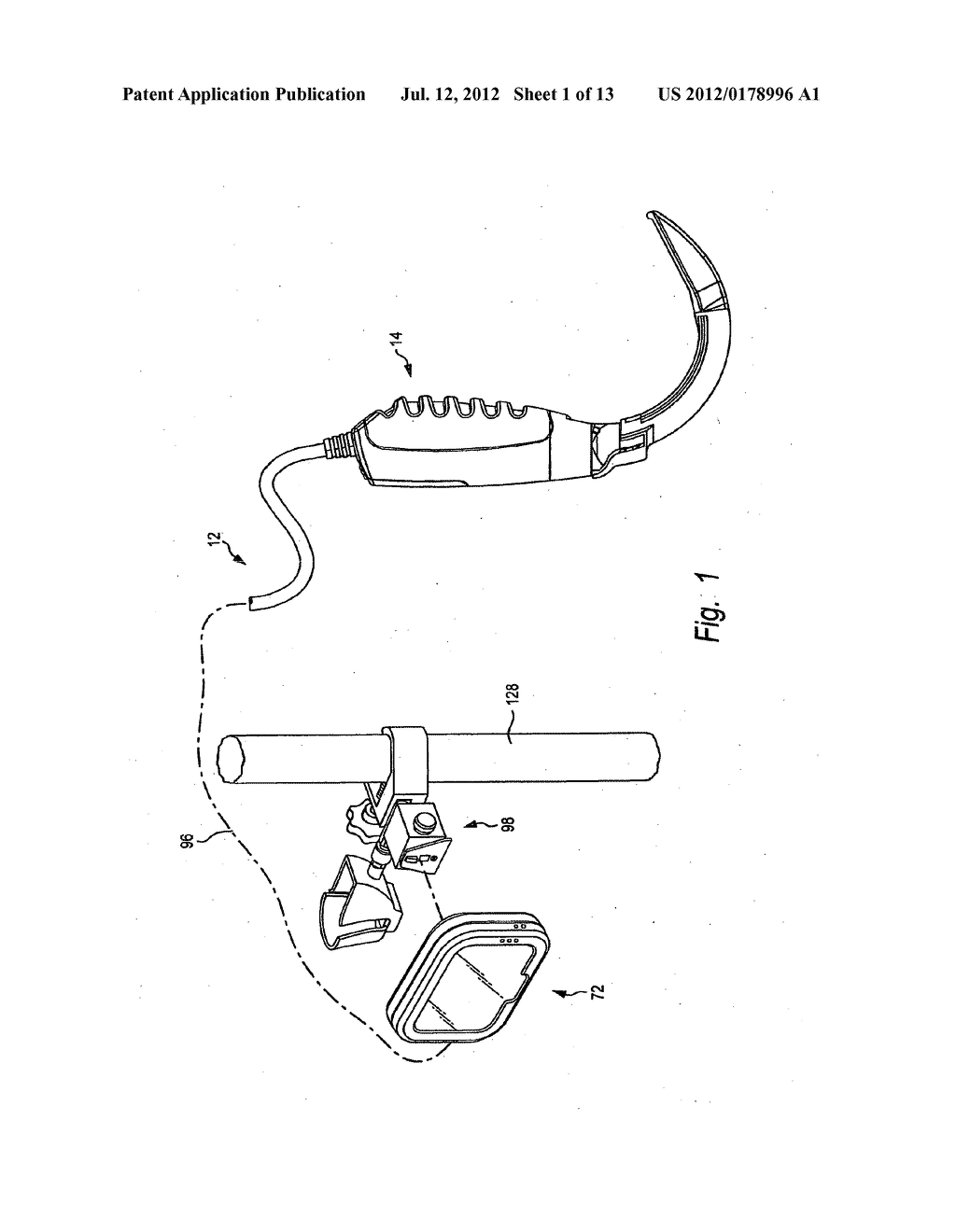 System and method for viewing oropharyngeal area - diagram, schematic, and image 02