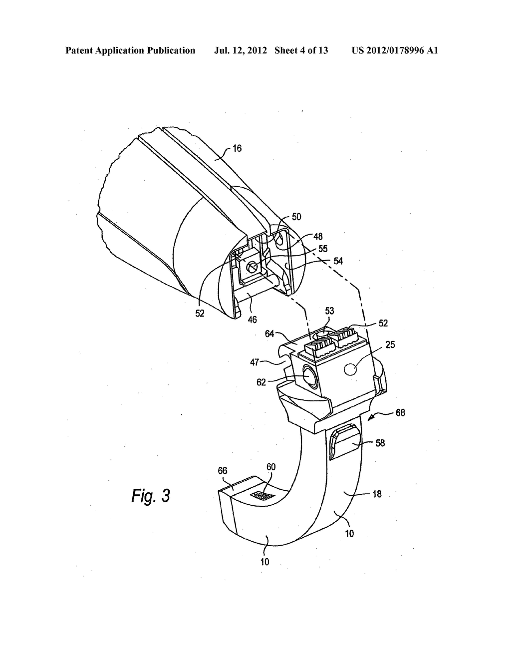 System and method for viewing oropharyngeal area - diagram, schematic, and image 05