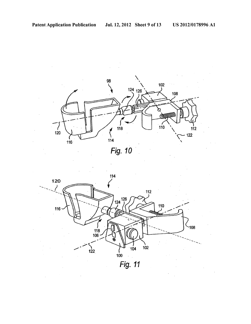 System and method for viewing oropharyngeal area - diagram, schematic, and image 10