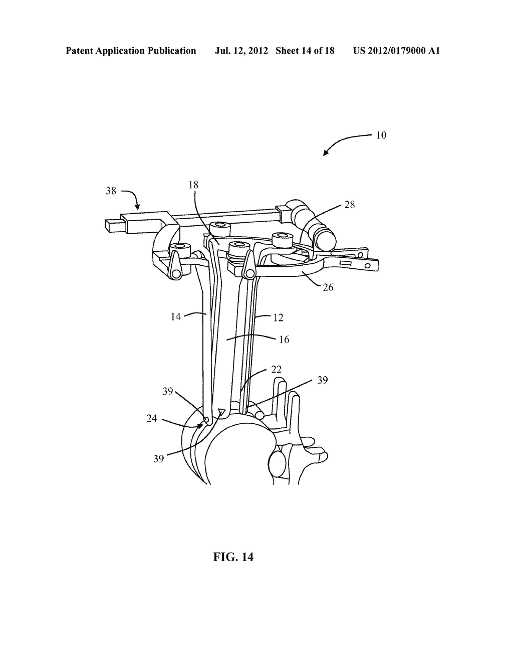 SURGICAL ACCESS SYSTEM AND RELATED METHODS - diagram, schematic, and image 15