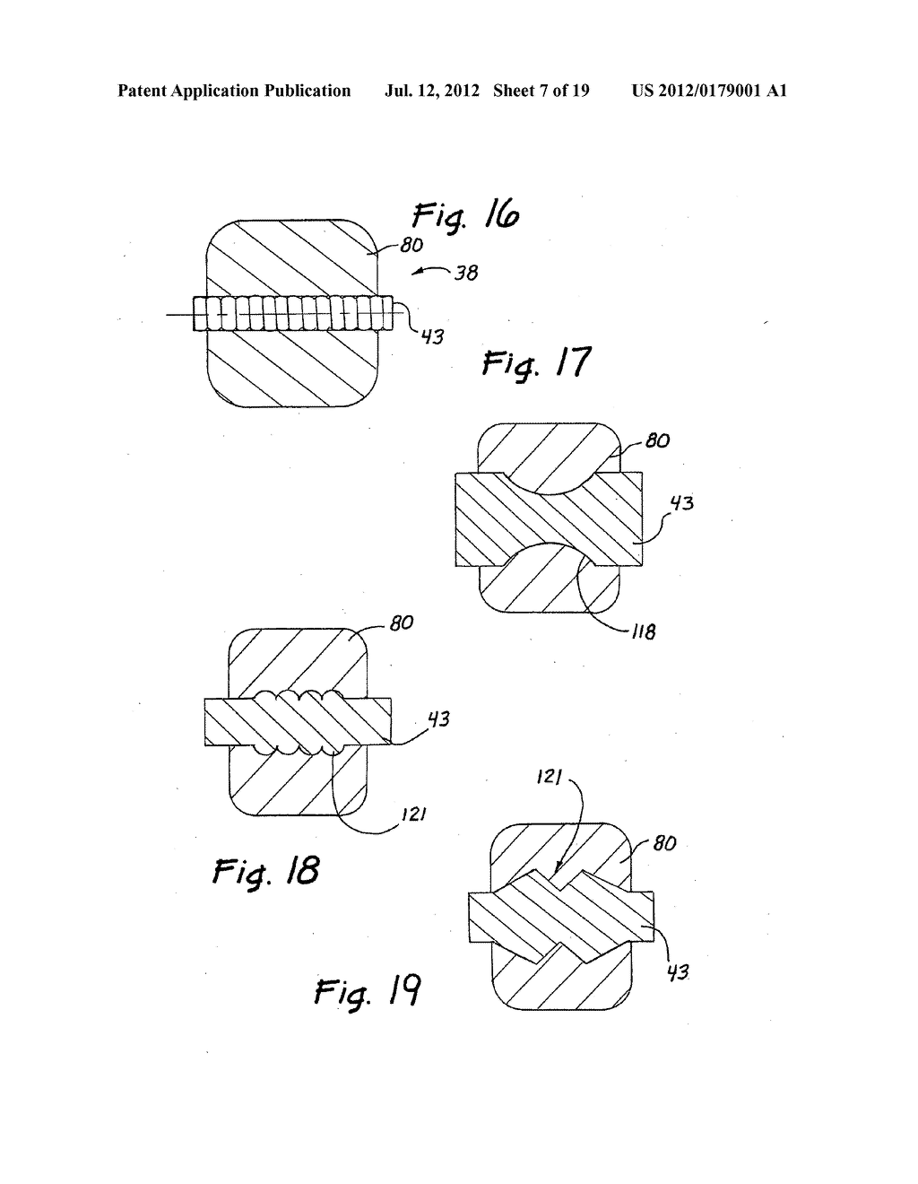 ACCESS SEALING APPARATUS AND METHOD - diagram, schematic, and image 08