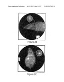 METHODS AND SYSTEMS FOR PROLONGED LOCALIZATION OF DRUG DELIVERY diagram and image