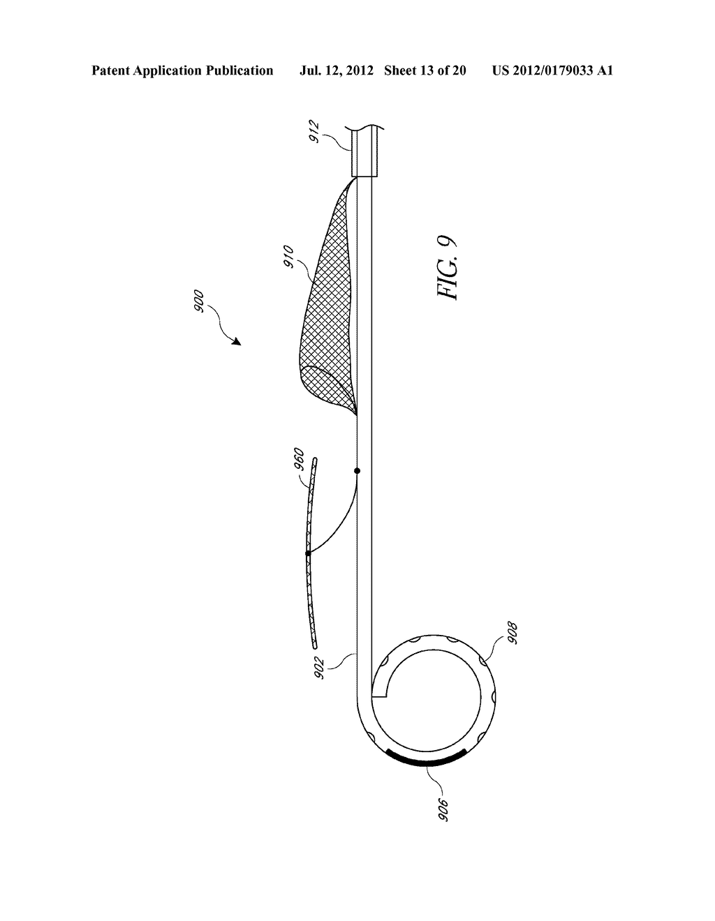 ANGIOGRAPHY CATHETER - diagram, schematic, and image 14