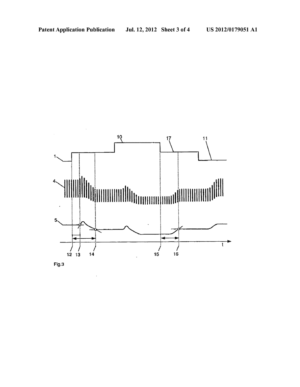 APPARATUS AND COMPUTER PROGRAM FOR DETERMINING A PATIENT'S VOLEMIC STATUS     REPRESENTED BY CARDIOPULMONARY BLOOD VOLUME - diagram, schematic, and image 04