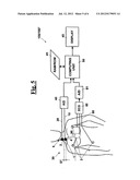 APPARATUS FOR MEASURING A PROPAGATION VELOCITY OF A BLOOD PRESSURE WAVE diagram and image