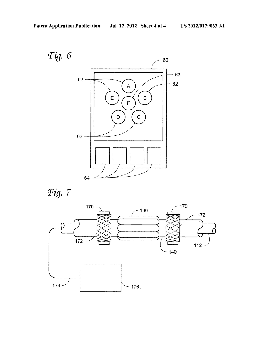 SYSTEMS, DEVICES AND METHODS FOR ASSESSMENT OF BODY CAVITY PRESSURES - diagram, schematic, and image 05