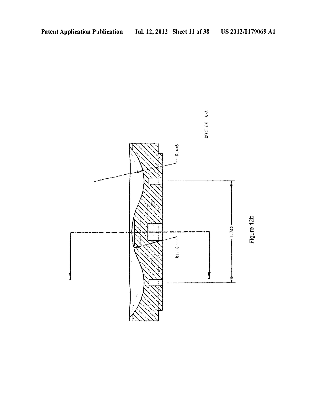 DEVICE AND METHOD OF SPACER AND TRIAL DESIGN DURING JOINT ARTHROPLASTY - diagram, schematic, and image 12