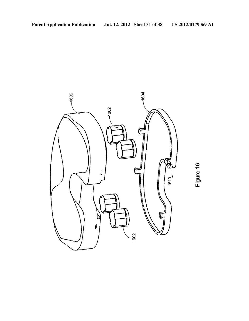 DEVICE AND METHOD OF SPACER AND TRIAL DESIGN DURING JOINT ARTHROPLASTY - diagram, schematic, and image 32