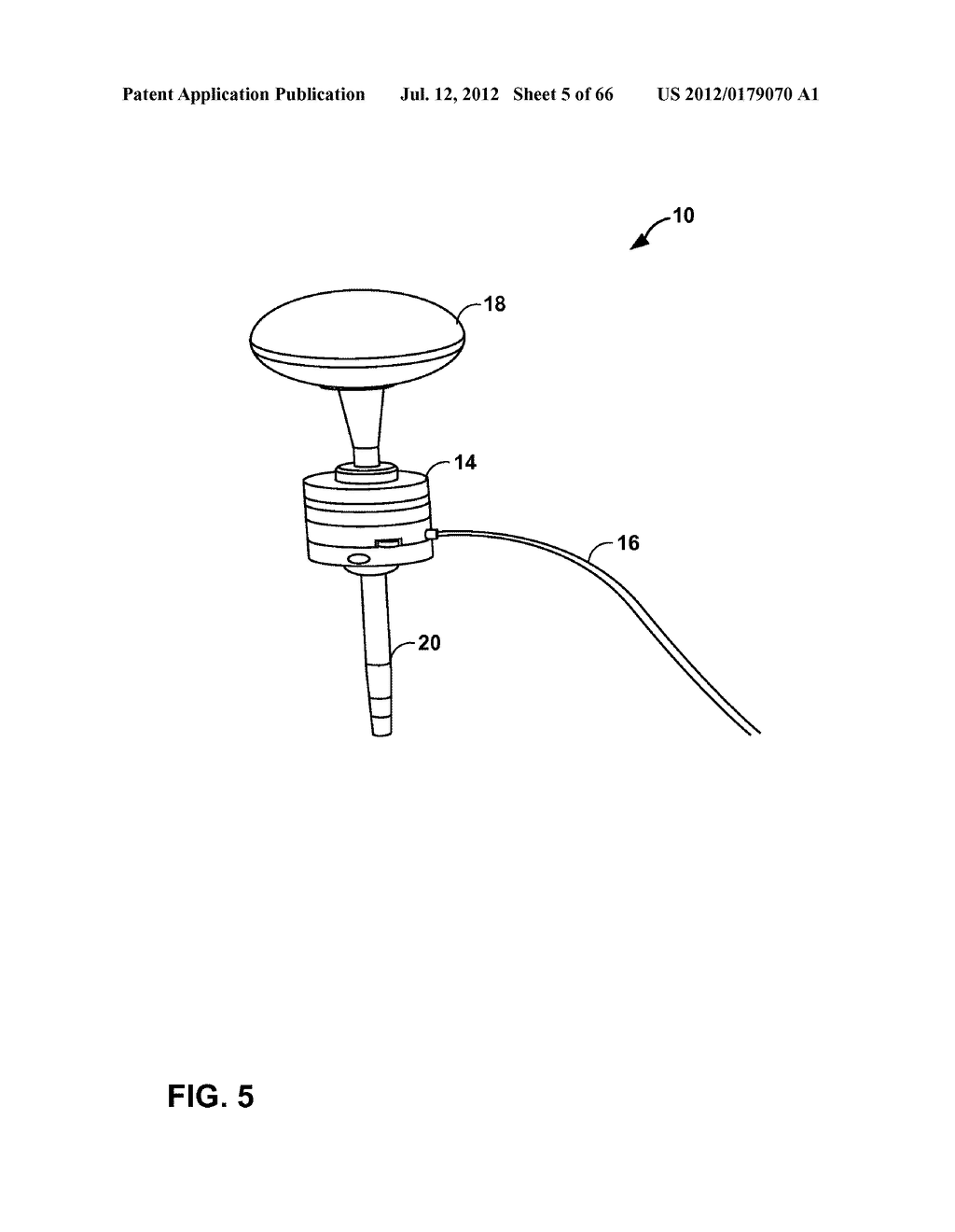 SPINAL PROBE WITH TACTILE FORCE FEEDBACK AND PEDICLE BREACH PREDICTION - diagram, schematic, and image 06