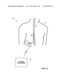 ASSOCIATING THERAPY ADJUSTMENTS WITH POSTURE STATES USING A STABILITY     TIMER diagram and image