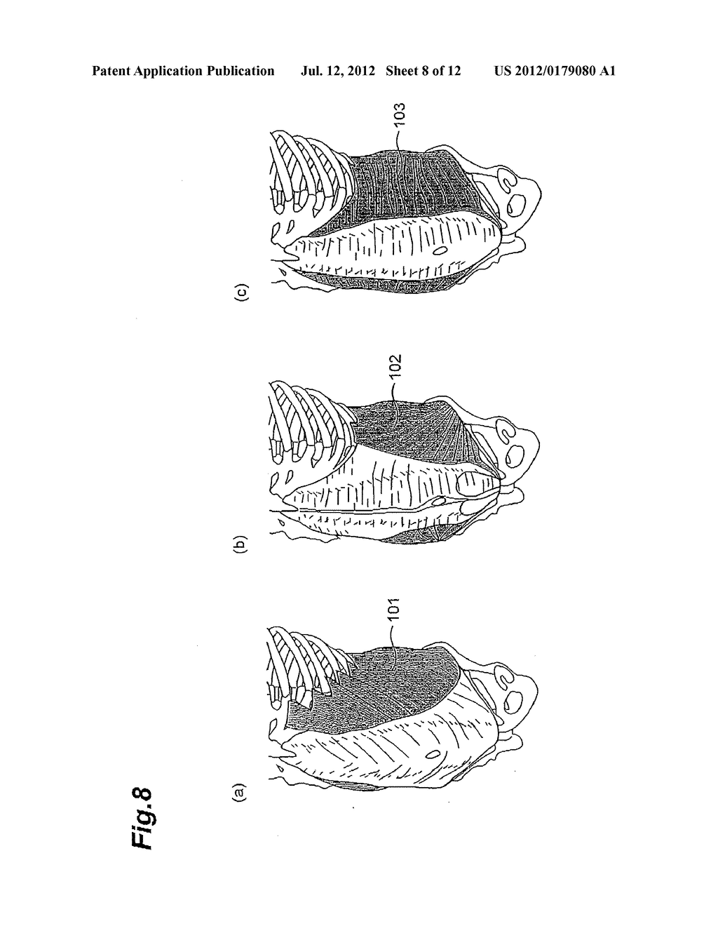 POSTURE-IMPROVING SUPPORT GARMENT - diagram, schematic, and image 09