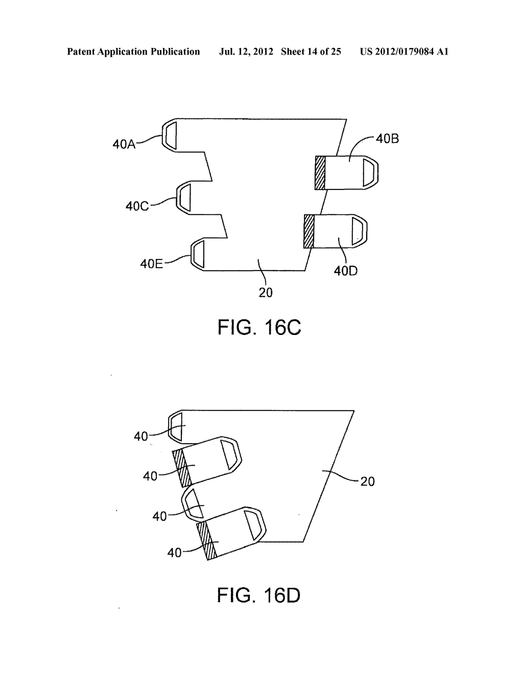 Graduated Compression Device Having Separate Body and Bands - diagram, schematic, and image 15