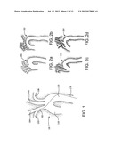 METHODS AND APPARATUS FOR AN ADJUSTABLE STIFFNESS CATHETER diagram and image