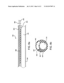 METHODS AND APPARATUS FOR AN ADJUSTABLE STIFFNESS CATHETER diagram and image